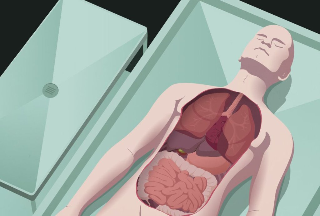 Autopsy Examination